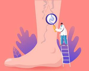 Почему стоит посетить центр флебологии МИФЦ